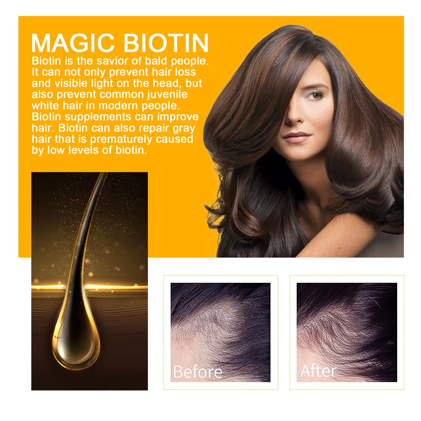Biotin Hair Care Spray Nourish Scalp Hair Follicle Reduce Hair Loss Stabiliz Hair Root Refresh Oil Control Natural Plant Essence