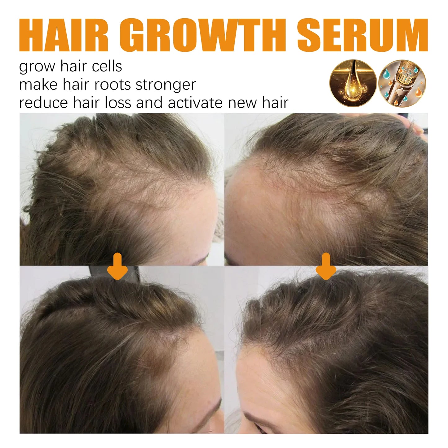 Biotin Hair Care Spray Nourish Scalp Hair Follicle Reduce Hair Loss Stabiliz Hair Root Refresh Oil Control Natural Plant Essence