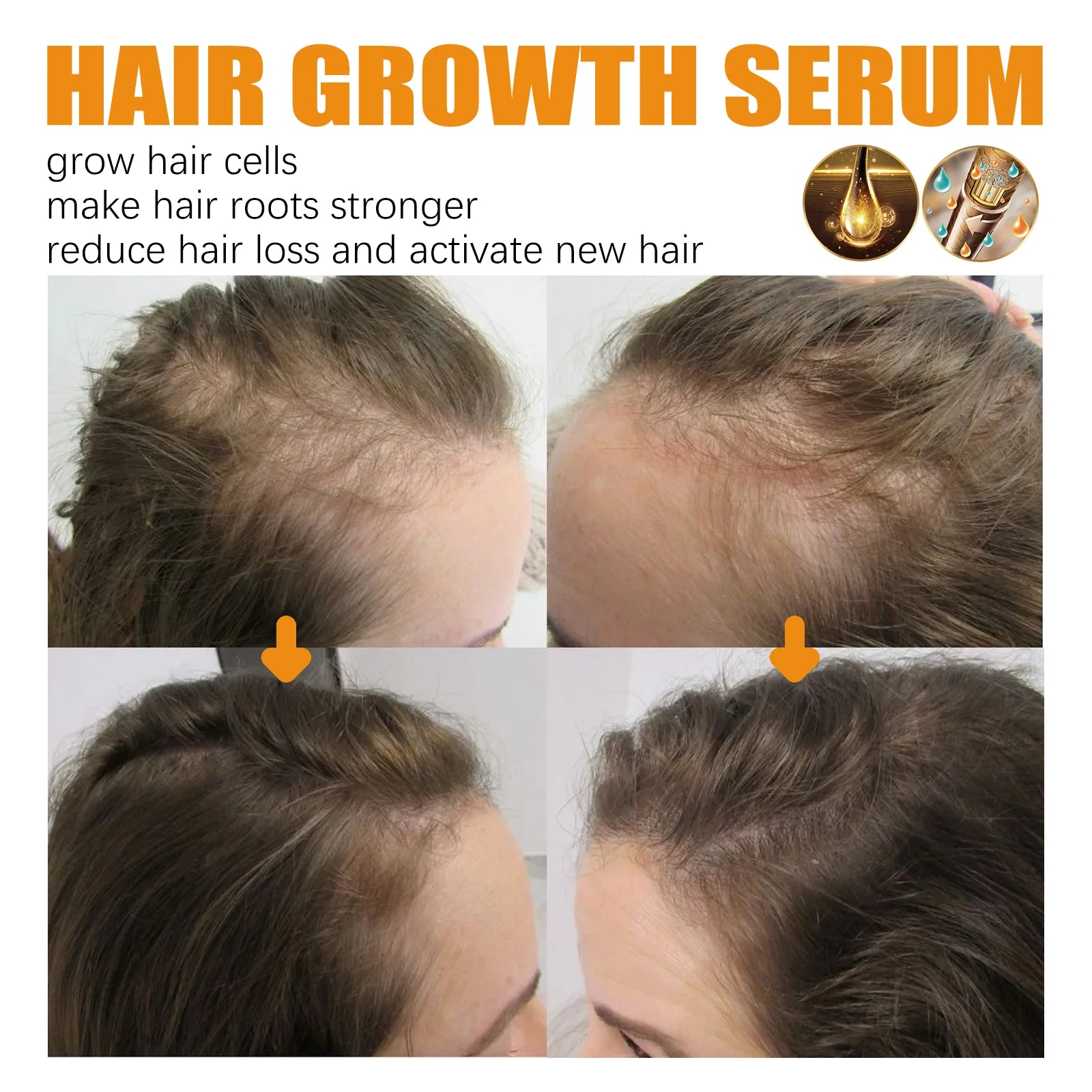 Biotin Hair Care Spray Nourish Scalp Hair Follicle Reduce Hair Loss Stabiliz Hair Root Refresh Oil Control Natural Plant Essence